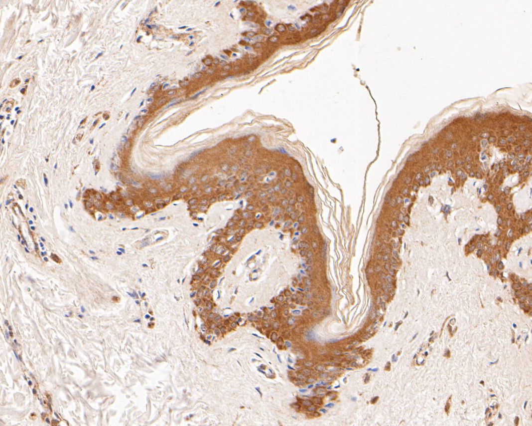 Fig2:; Immunohistochemical analysis of paraffin-embedded human skin tissue using anti-GADD34 antibody. The section was pre-treated using heat mediated antigen retrieval with Tris-EDTA buffer (pH 8.0-8.4) for 20 minutes.The tissues were blocked in 5% BSA for 30 minutes at room temperature, washed with ddH; 2; O and PBS, and then probed with the primary antibody ( 1/200) for 30 minutes at room temperature. The detection was performed using an HRP conjugated compact polymer system. DAB was used as the chromogen. Tissues were counterstained with hematoxylin and mounted with DPX.