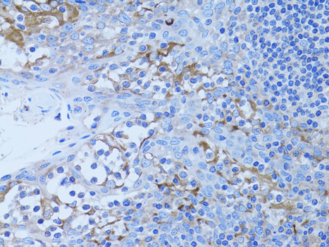 Immunohistochemistry - HADH Polyclonal Antibody 