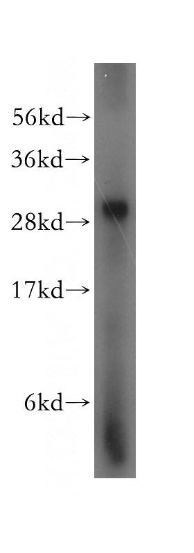 human brain tissue were subjected to SDS PAGE followed by western blot with Catalog No:112215(LHPP antibody) at dilution of 1:500