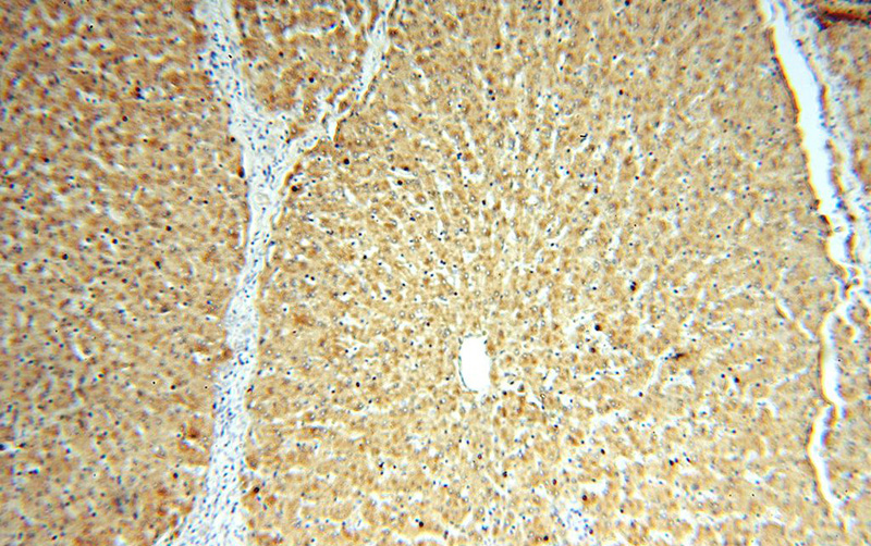 Immunohistochemical of paraffin-embedded human liver using Catalog No:107728(ACAT2 antibody) at dilution of 1:100 (under 10x lens)