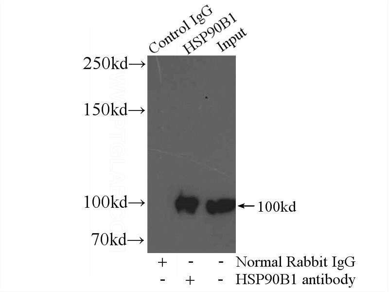 IP Result of anti-GRP94 (IP:Catalog No:111223, 3ug; Detection:Catalog No:111223 1:1000) with mouse liver tissue lysate 4000ug.
