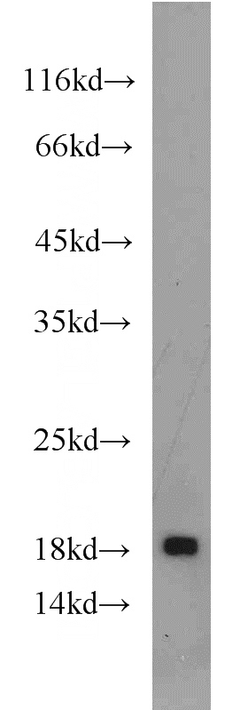 PC-3 cells were subjected to SDS PAGE followed by western blot with Catalog No:110011(TNFRSF25 antibody) at dilution of 1:600