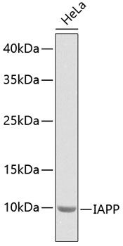 Western blot - IAPP Polyclonal Antibody 