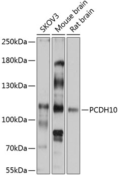 Western blot - PCDH10 Polyclonal Antibody 