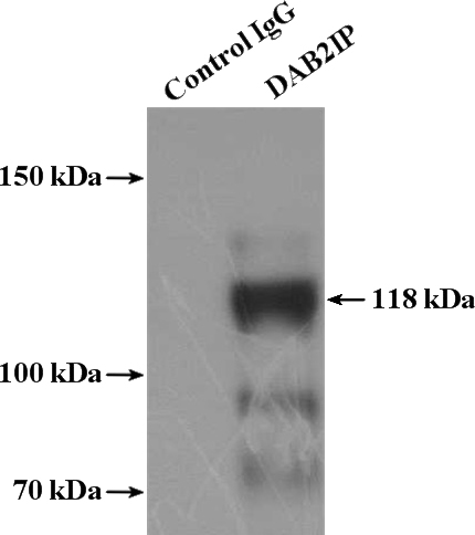 IP Result of anti-DAB2IP (IP:Catalog No:109852, 4ug; Detection:Catalog No:109852 1:1000) with mouse brain tissue lysate 4000ug.