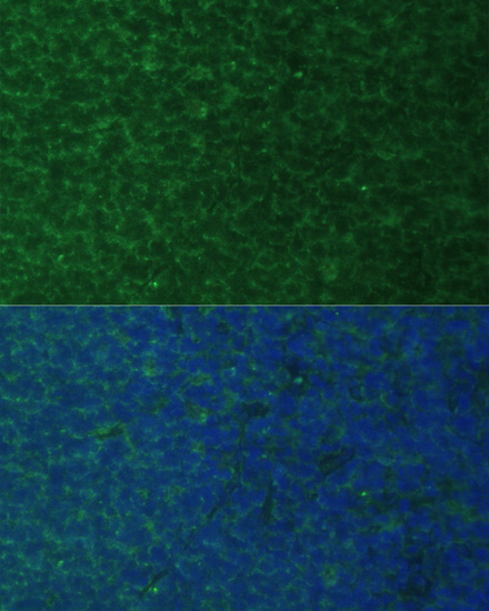 Immunofluorescence - PMAIP1 Polyclonal Antibody 
