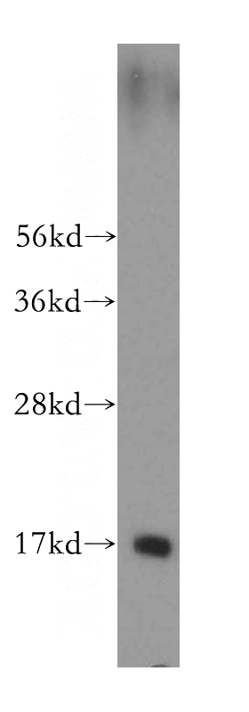 human vein tissue were subjected to SDS PAGE followed by western blot with Catalog No:108050(ANG antibody) at dilution of 1:300