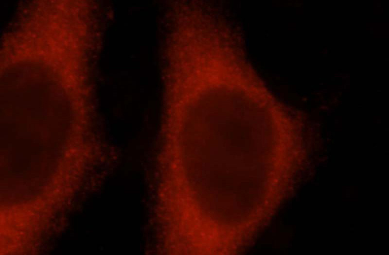 Immunofluorescent analysis of Hela cells, using ATP1A2 antibody Catalog No:108342 at 1:25 dilution and Rhodamine-labeled goat anti-rabbit IgG (red).