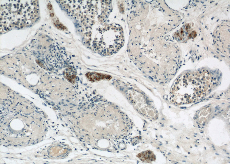 Immunohistochemical of paraffin-embedded human testis using Catalog No:109679(CYP11A1 antibody) at dilution of 1:50 (under 10x lens)