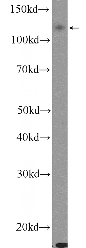 HepG2 cells were subjected to SDS PAGE followed by western blot with Catalog No:110466(FAM120C Antibody) at dilution of 1:600