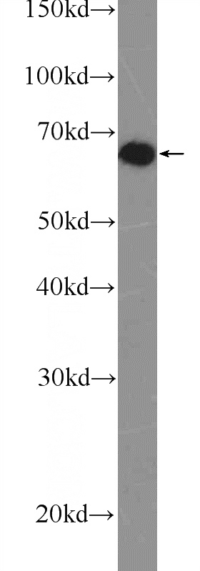 MCF-7 cells were subjected to SDS PAGE followed by western blot with Catalog No:115468(SNW1 Antibody) at dilution of 1:600