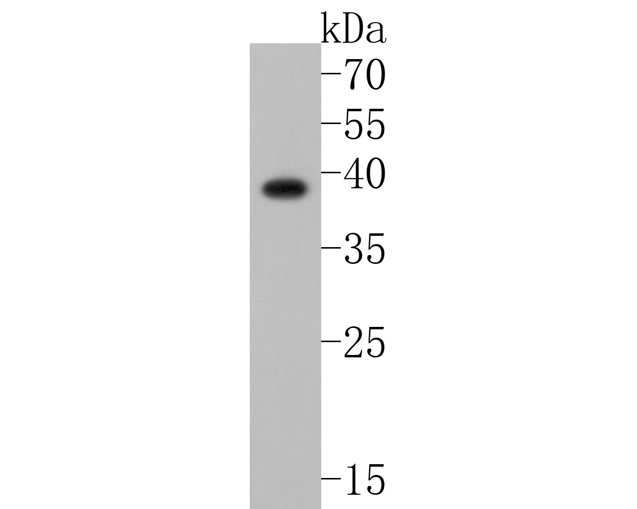 Fig1:; Western blot analysis of MC-2 on SiHa cell lysates. Proteins were transferred to a PVDF membrane and blocked with 5% NFTM/TBST for 1 hour at room temperature. The primary antibody ( 1/500) was used in 5% NFTM/TBST at room temperature for 2 hours. Goat Anti-Rabbit IgG - HRP Secondary Antibody (HA1001) at 1:200,000 dilution was used for 1 hour at room temperature.