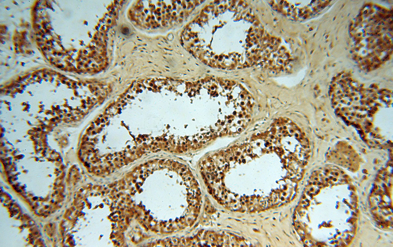 Immunohistochemical of paraffin-embedded human testis using Catalog No:113539(P19 antibody) at dilution of 1:50 (under 10x lens)