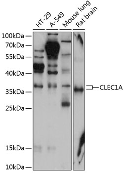 Western blot - CLEC1A Polyclonal Antibody 
