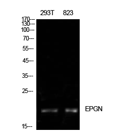 Fig1:; Western Blot analysis of 293T, 823 cells using Epigen Polyclonal Antibody. Antibody was diluted at 1:500. Secondary antibody（catalog#: HA1001) was diluted at 1:20000