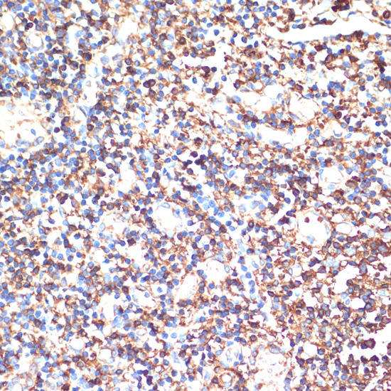 Immunohistochemistry - HLA-DRA Polyclonal Antibody 