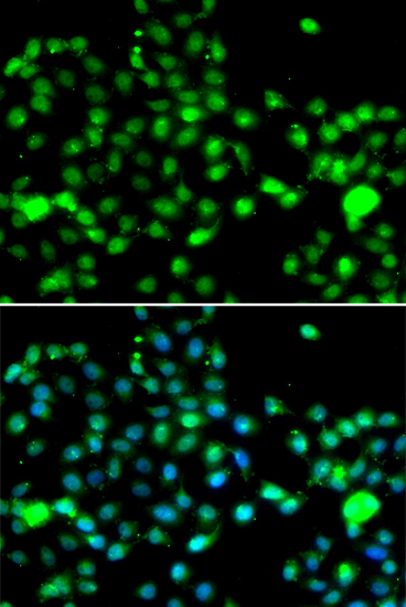 Immunofluorescence - IP6K2 Polyclonal Antibody 