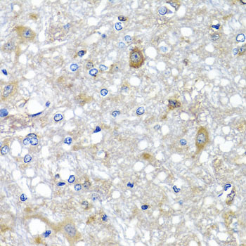 Immunohistochemistry - ETFA Polyclonal Antibody 