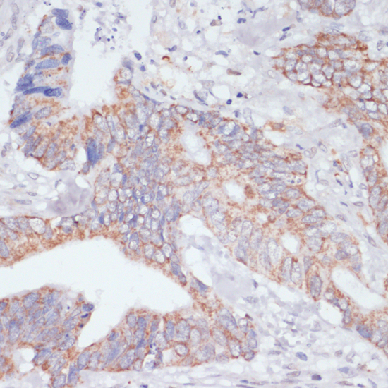 Immunohistochemistry - IKBKE Polyclonal Antibody 