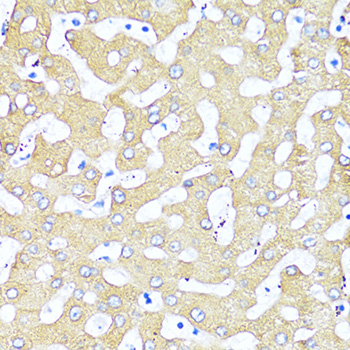 Immunohistochemistry - TGFB2 Polyclonal Antibody 