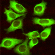 Immunocytochemistry of HeLa cells using Hsp27 mouse mAb (dilution 1:100).