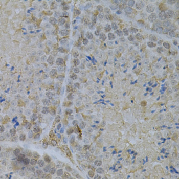 Immunohistochemistry - GLB1 Polyclonal Antibody 
