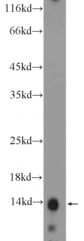 mouse kidney tissue were subjected to SDS PAGE followed by western blot with Catalog No:111405(Histone H2A.z Antibody) at dilution of 1:300