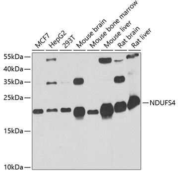 Western blot - NDUFS4 Polyclonal Antibody 