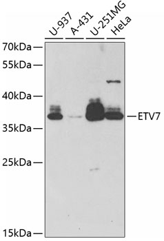 Western blot - ETV7 Polyclonal Antibody 
