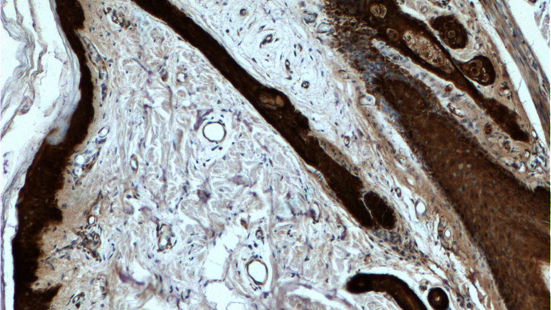 Immunohistochemistry of paraffin-embedded human skin tissue slide using Catalog No:107551(SFN Antibody) at dilution of 1:2000 (under 10x lens).