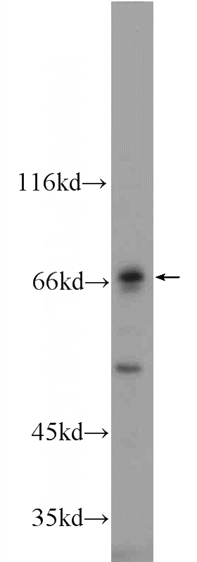 mouse liver tissue were subjected to SDS PAGE followed by western blot with Catalog No:112702(MMP21 Antibody) at dilution of 1:600