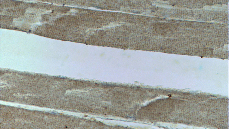 Immunohistochemistry of paraffin-embedded human skeletal muscle tissue slide using Catalog No:115245(SIRT4 Antibody) at dilution of 1:50 (under 40x lens)