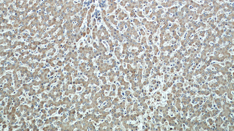 Immunohistochemical of paraffin-embedded human liver using Catalog No:107228(CYGB antibody) at dilution of 1:50 (under 10x lens)