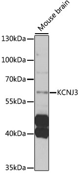 Western blot - KCNJ3 Polyclonal Antibody 