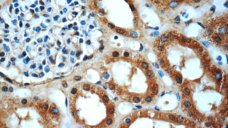 Immunohistochemistry of paraffin-embedded human kidney slide using Catalog No:110401(ERBB2IP Antibody) at dilution of 1:50