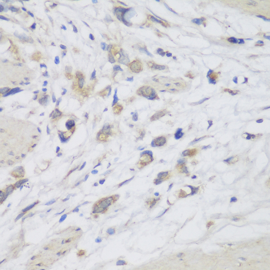 Immunohistochemistry - CEMIP Polyclonal Antibody 