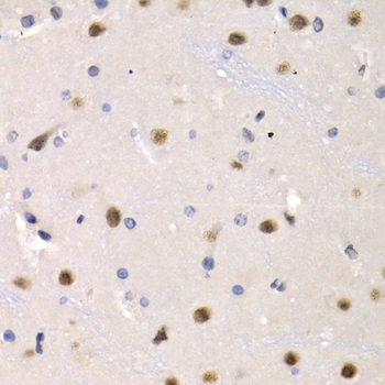 Immunohistochemistry - IRF2 Polyclonal Antibody 