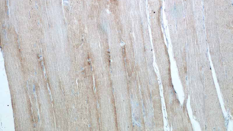 Immunohistochemistry of paraffin-embedded human skeletal muscle tissue slide using Catalog No:109331(CKMT2 Antibody) at dilution of 1:50 (under 10x lens)