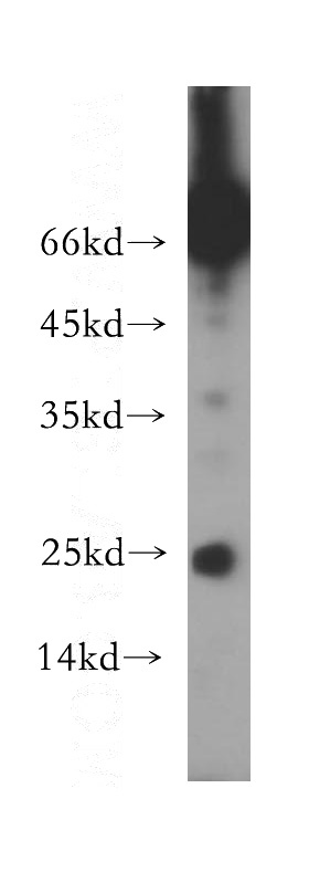 Raji cells were subjected to SDS PAGE followed by western blot with Catalog No:114387(PSMB7 antibody) at dilution of 1:200