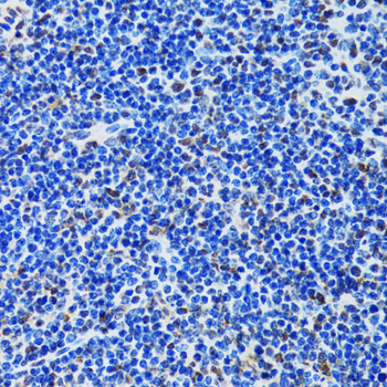 Immunohistochemistry - MTA3 Polyclonal Antibody 