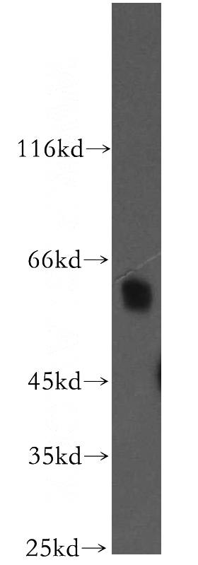 human heart tissue were subjected to SDS PAGE followed by western blot with Catalog No:113012(NAB2 antibody) at dilution of 1:500