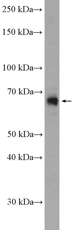 PC-3 cells were subjected to SDS PAGE followed by western blot with Catalog No:114253(PSPC1 Antibody) at dilution of 1:1000