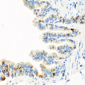 Immunohistochemistry - RGS5 Polyclonal Antibody 
