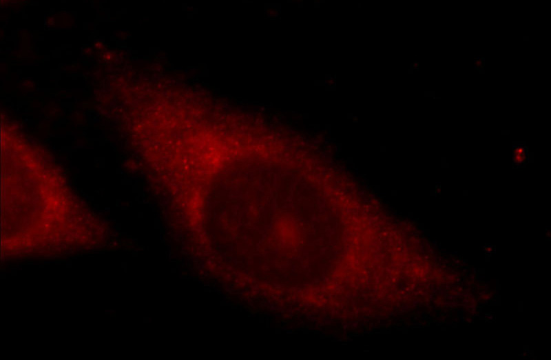 Immunofluorescent analysis of HepG2 cells using Catalog No:117040(ZFP36 Antibody) at dilution of 1:25 and Rhodamine-Goat anti-Rabbit IgG