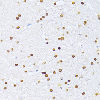 Immunohistochemistry - ZEB2 Polyclonal Antibody 