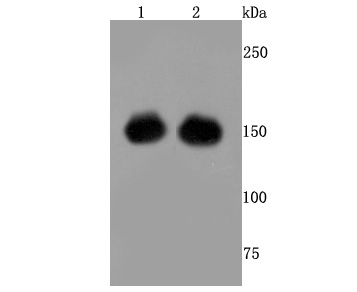 Fig1:; Western blot analysis of CRISPR-Cas9 SP on different lysates. Proteins were transferred to a PVDF membrane and blocked with 5% BSA in PBS for 1 hour at room temperature. The primary antibody ( 1/500) was used in 5% BSA at room temperature for 2 hours. Goat Anti-Rabbit IgG - HRP Secondary Antibody (HA1001) at 1:5,000 dilution was used for 1 hour at room temperature.; Positive control:; Lane 1: 293 cell lysates transfected with CRISPR-Cas9; Lane 2: 293T cell lysates transfected with CRISPR-Cas9