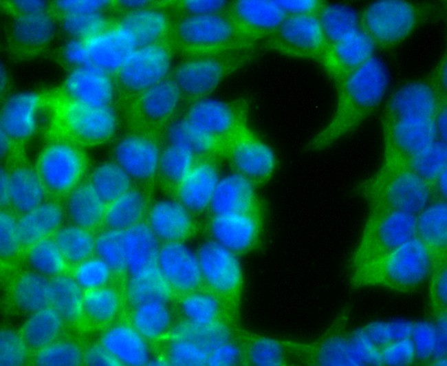 Fig2:; ICC staining of Ephrin B2 in 293T cells (green). Formalin fixed cells were permeabilized with 0.1% Triton X-100 in TBS for 10 minutes at room temperature and blocked with 10% negative goat serum for 15 minutes at room temperature. Cells were probed with the primary antibody ( 1/50) for 1 hour at room temperature, washed with PBS. Alexa Fluor®488 conjugate-Goat anti-Rabbit IgG was used as the secondary antibody at 1/1,000 dilution. The nuclear counter stain is DAPI (blue).