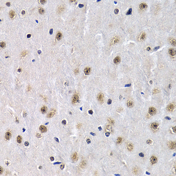 Immunohistochemistry - PTHLH Polyclonal Antibody 