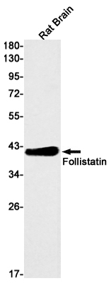 Western blot detection of Follistatin in Rat Brain lysates using Follistatin Rabbit mAb(1:1000 diluted).Predicted band size:38kDa.Observed band size:38kDa.