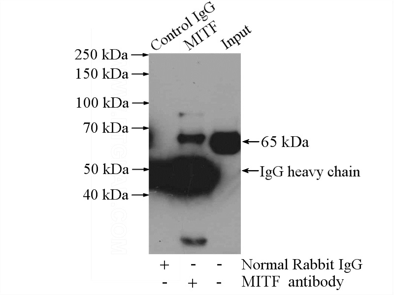 IP Result of anti-MITF (IP:Catalog No:112661, 4ug; Detection:Catalog No:112661 1:1000) with mouse heart tissue lysate 4000ug.